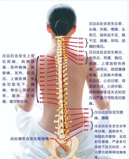 保護(hù)腰椎—示范腰椎保健操，趕快收藏吧