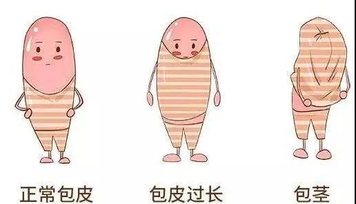 【保山安利醫(yī)院】家長(zhǎng)速看！暑期包皮手術(shù)預(yù)約正當(dāng)時(shí)！