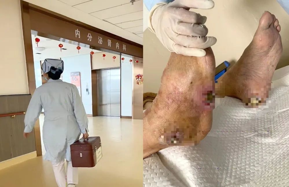 【保山安利醫(yī)院】傷口治療一站式，健康生活零距離！